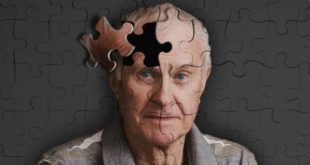 Origen del Alzheimer