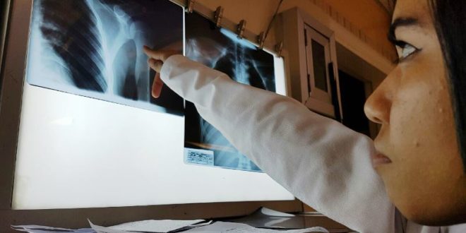 HEU realiza más de 344 mil exámenes radiológicos cada año