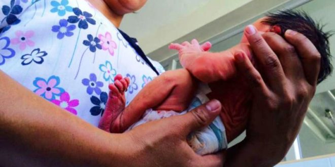 Nace primer bebe con microcefalia en mayo: Hospital Escuela