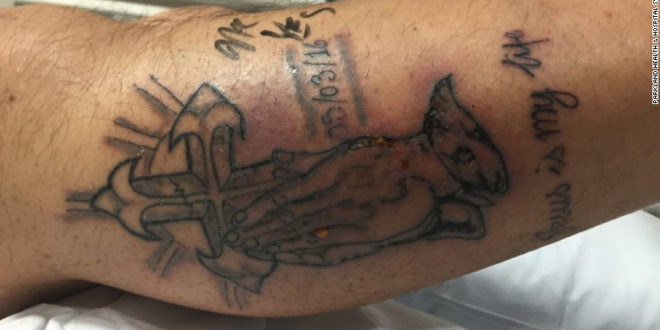 Un hombre murió por nadar tras hacerse un tatuaje