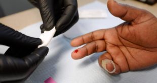 Salud implementará nuevos modelos de atención TB/VIH