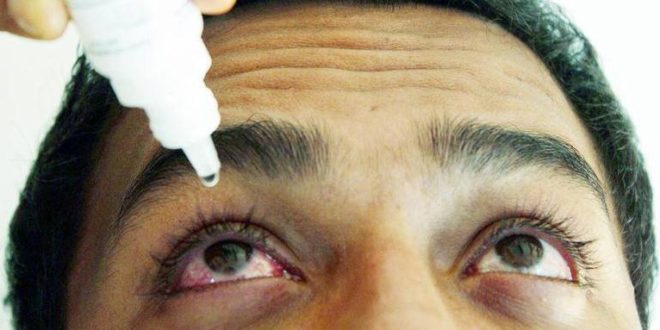 Aumentan los casos de conjuntivitis