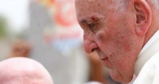 El Papa sufre un ligero golpe