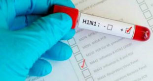 Influenza H1N1 en Honduras