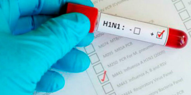 Influenza H1N1 en Honduras