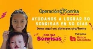 Operación Sonrisa se une nuevamente a Banco Atlántida para cambiar 30 vidas, en 30 días