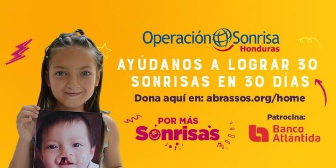 Operación Sonrisa se une nuevamente a Banco Atlántida para cambiar 30 vidas, en 30 días