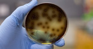 EEUU: encuentran un microbio "comecerebro" en el agua del grifo