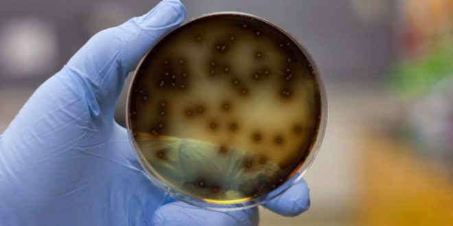 EEUU: encuentran un microbio "comecerebro" en el agua del grifo